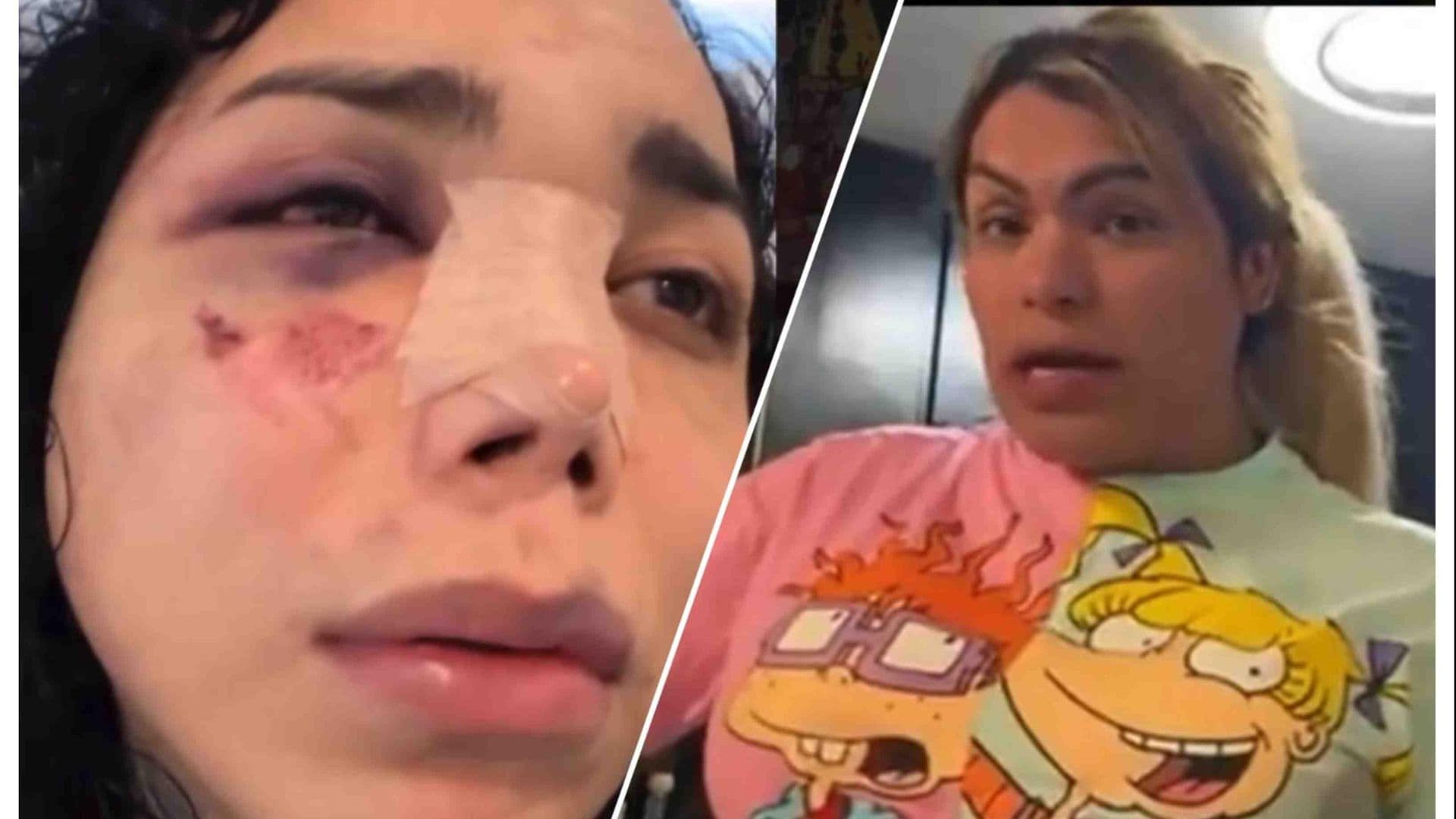Wendy Guevara Narra Cómo Saltó del Balcón su Amiga, Paola Suárez y Ella Teme Perder su Ojo