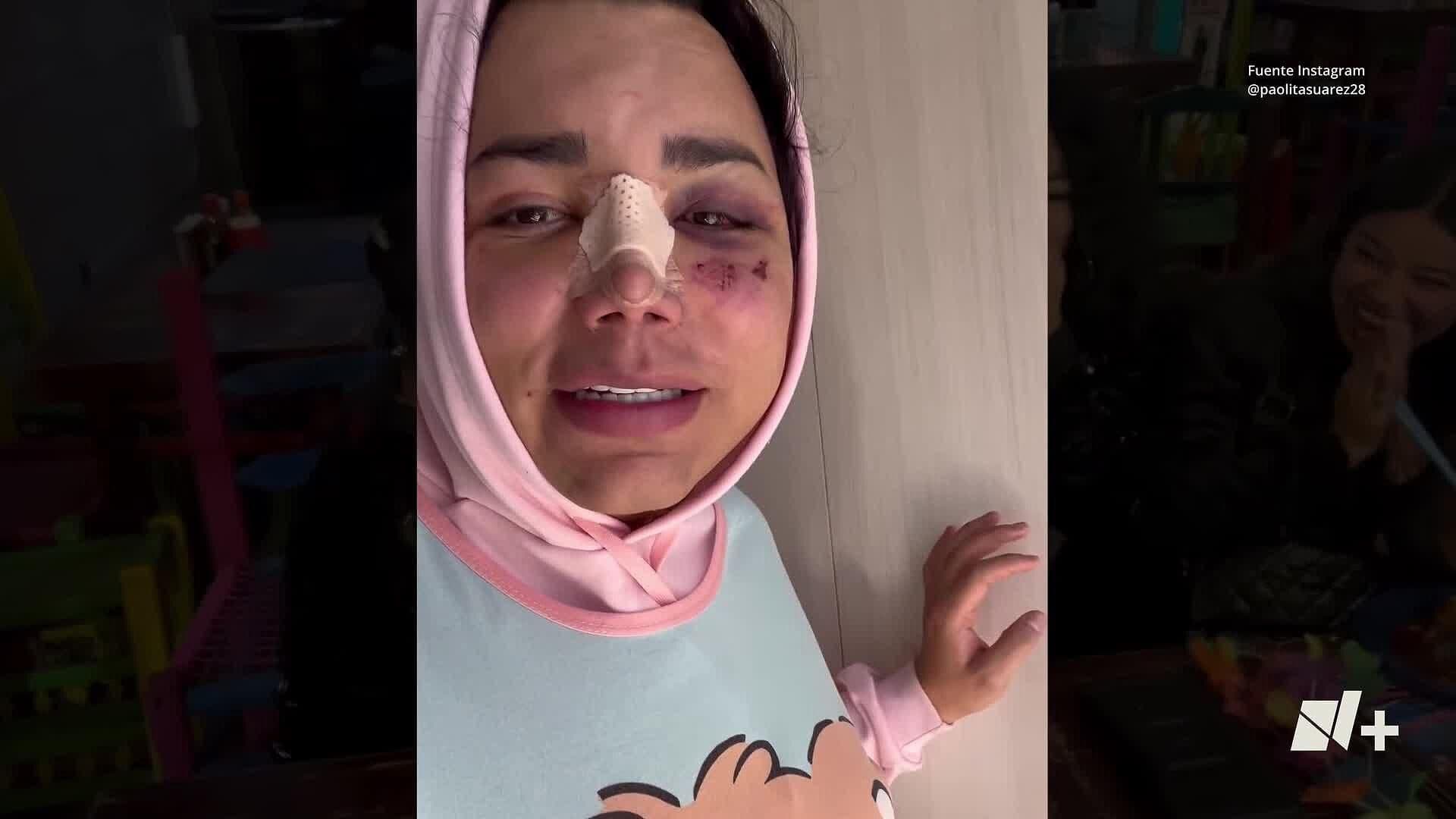 Dan de Alta del Hospital a Paola Suárez Después de la Golpiza que le Dio su Pareja