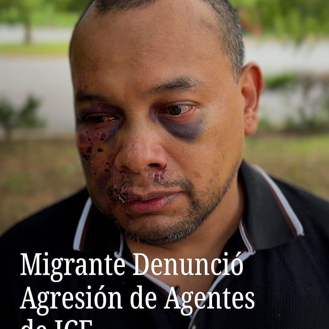 Un Inmigrante Denuncia Agresión de Agentes de ICE