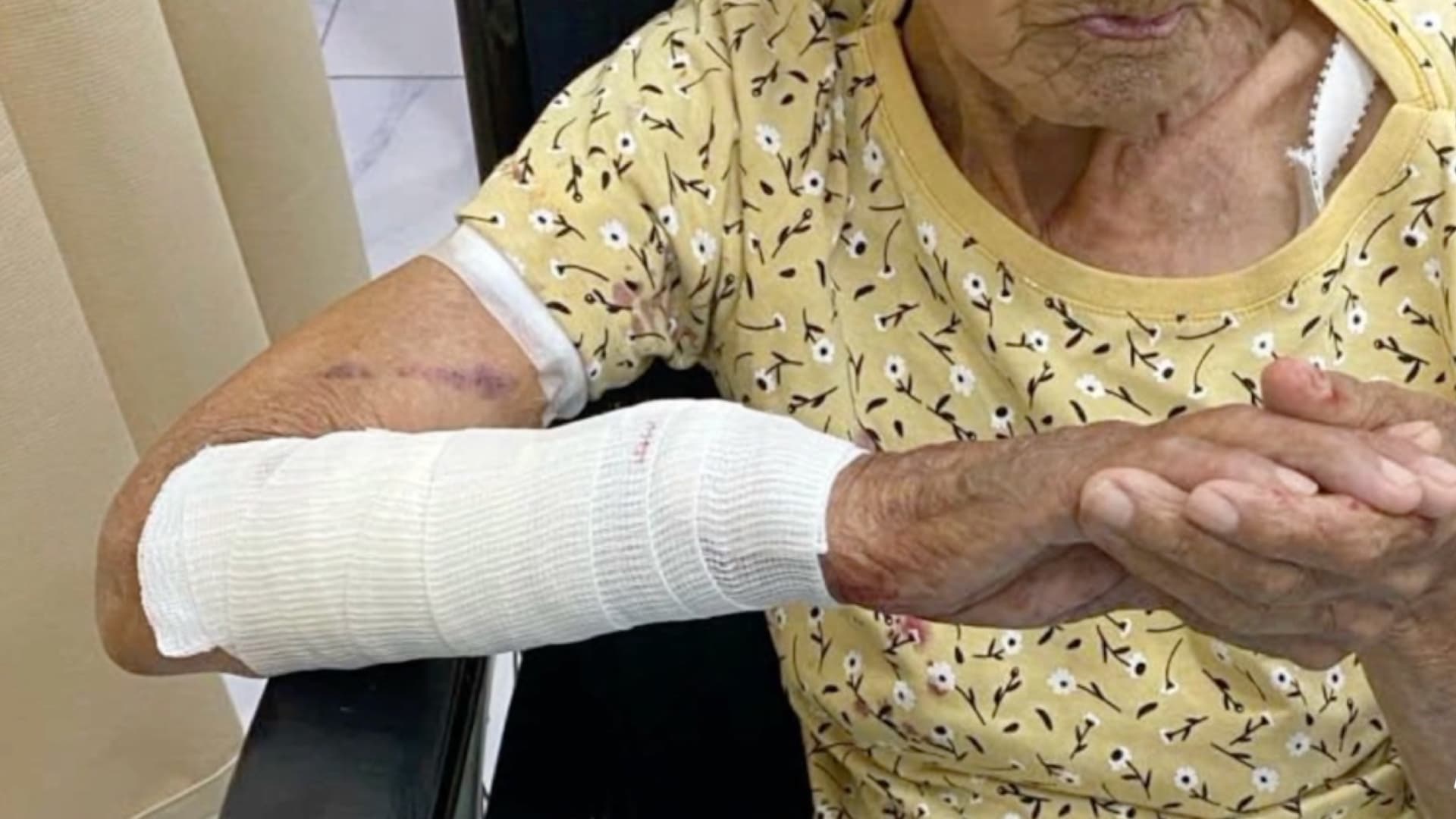 Perro Ataca a Mujer en Nuevo Laredo