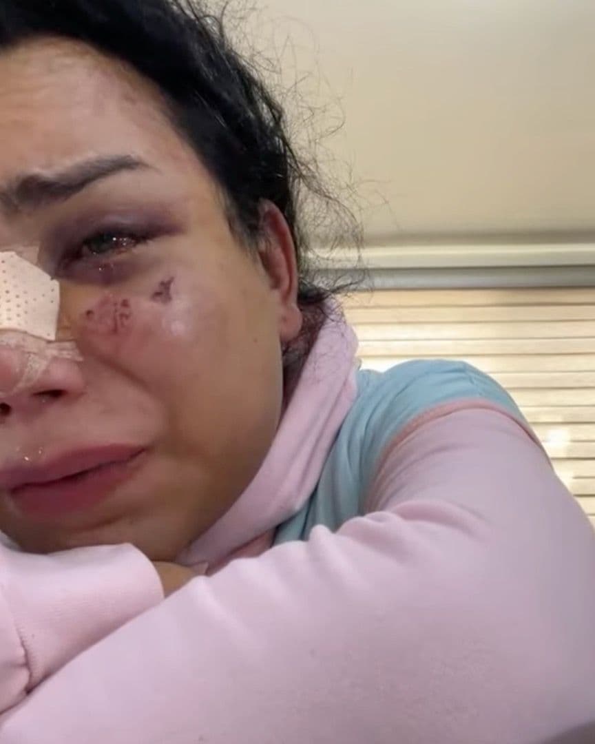 Paola Suárez es dada de alta tras agresión física