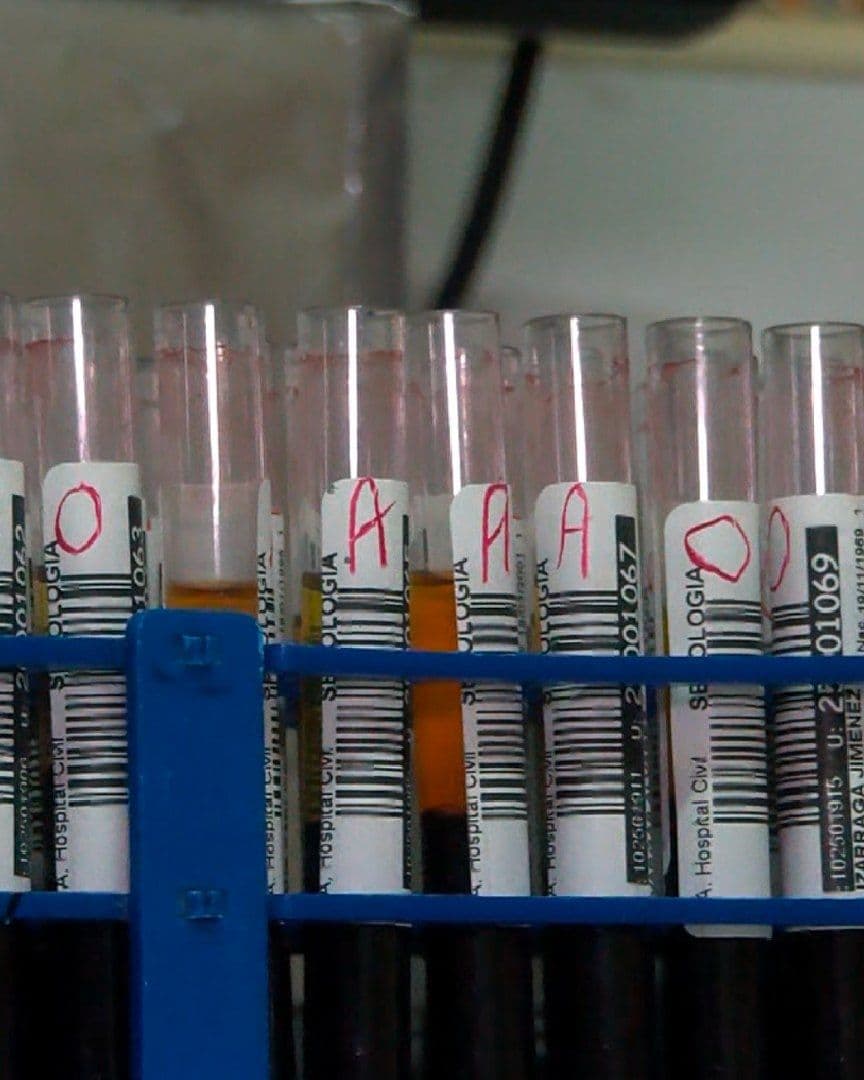 Acusan a un presunto doctor por brote de hepatitis C en Tepatitlán