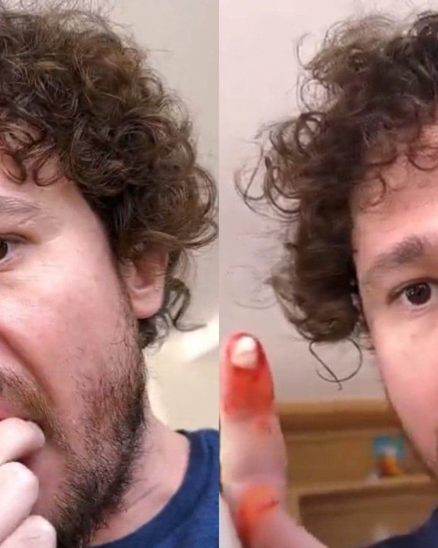 ¿La caída de dientes fue real o Luisito Comunica está próximo a inaugurar una clínica dental?